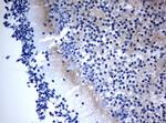 VSNL1 Antibody in Immunohistochemistry (Paraffin) (IHC (P))