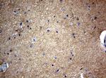 VSNL1 Antibody in Immunohistochemistry (Paraffin) (IHC (P))