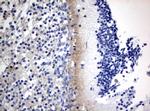 VSNL1 Antibody in Immunohistochemistry (Paraffin) (IHC (P))