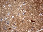 VSNL1 Antibody in Immunohistochemistry (Paraffin) (IHC (P))