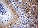 VSNL1 Antibody in Immunohistochemistry (Paraffin) (IHC (P))
