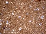 VSNL1 Antibody in Immunohistochemistry (Paraffin) (IHC (P))