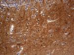 VSNL1 Antibody in Immunohistochemistry (Paraffin) (IHC (P))