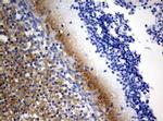 VSNL1 Antibody in Immunohistochemistry (Paraffin) (IHC (P))