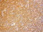 VSNL1 Antibody in Immunohistochemistry (Paraffin) (IHC (P))