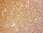 VSNL1 Antibody in Immunohistochemistry (Paraffin) (IHC (P))
