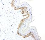 VSNL1 Antibody in Immunohistochemistry (Paraffin) (IHC (P))