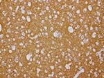 VSNL1 Antibody in Immunohistochemistry (Paraffin) (IHC (P))