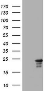 VSNL1 Antibody in Western Blot (WB)
