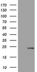 VSNL1 Antibody in Western Blot (WB)