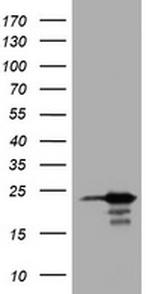 VSNL1 Antibody in Western Blot (WB)