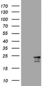 VSNL1 Antibody in Western Blot (WB)