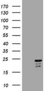 VSNL1 Antibody in Western Blot (WB)