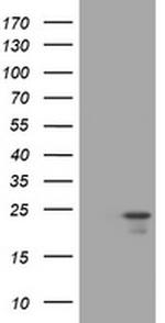 VSNL1 Antibody in Western Blot (WB)