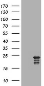 VSNL1 Antibody in Western Blot (WB)