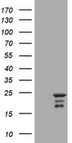 VSNL1 Antibody in Western Blot (WB)