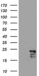 VSNL1 Antibody in Western Blot (WB)
