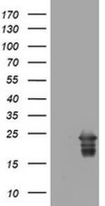 VSNL1 Antibody in Western Blot (WB)