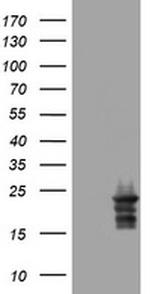 VSNL1 Antibody in Western Blot (WB)