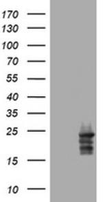 VSNL1 Antibody in Western Blot (WB)
