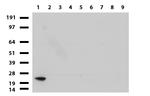 VSNL1 Antibody in Western Blot (WB)