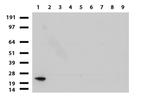 VSNL1 Antibody in Western Blot (WB)
