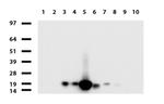 VSNL1 Antibody in Western Blot (WB)