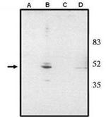 CHX10 Polyclonal Antibody