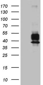 VTCN1 Antibody in Western Blot (WB)