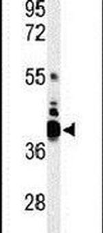 B7-H4 Antibody in Western Blot (WB)