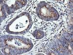 VTI1A Antibody in Immunohistochemistry (Paraffin) (IHC (P))