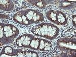VTI1A Antibody in Immunohistochemistry (Paraffin) (IHC (P))