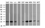 VTI1A Antibody in Western Blot (WB)