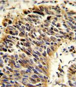 Vitronectin Antibody in Immunohistochemistry (IHC)