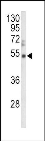 Vitronectin Antibody in Western Blot (WB)