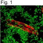 VWF Antibody in Immunohistochemistry (IHC)