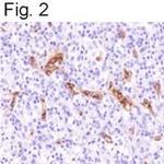 VWF Antibody in Immunohistochemistry (IHC)