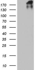 VWF Antibody in Western Blot (WB)