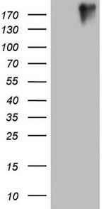 VWF Antibody in Western Blot (WB)