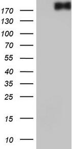 VWF Antibody in Western Blot (WB)