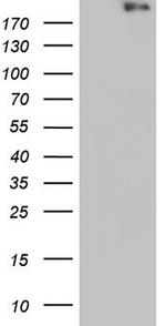 VWF Antibody in Western Blot (WB)