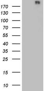 VWF Antibody in Western Blot (WB)