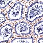 Villin Antibody in Immunohistochemistry (IHC)