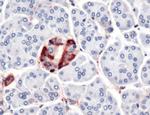 Vinculin Antibody in Immunohistochemistry (IHC)