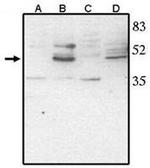 CHX10 Polyclonal Antibody