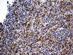 WASL Antibody in Immunohistochemistry (Paraffin) (IHC (P))