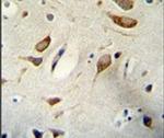 WBP2 Antibody in Immunohistochemistry (IHC)