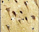 WBP2 Antibody in Immunohistochemistry (IHC)