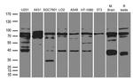 WDR48 Antibody in Western Blot (WB)