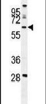 WDR49 Antibody in Western Blot (WB)
